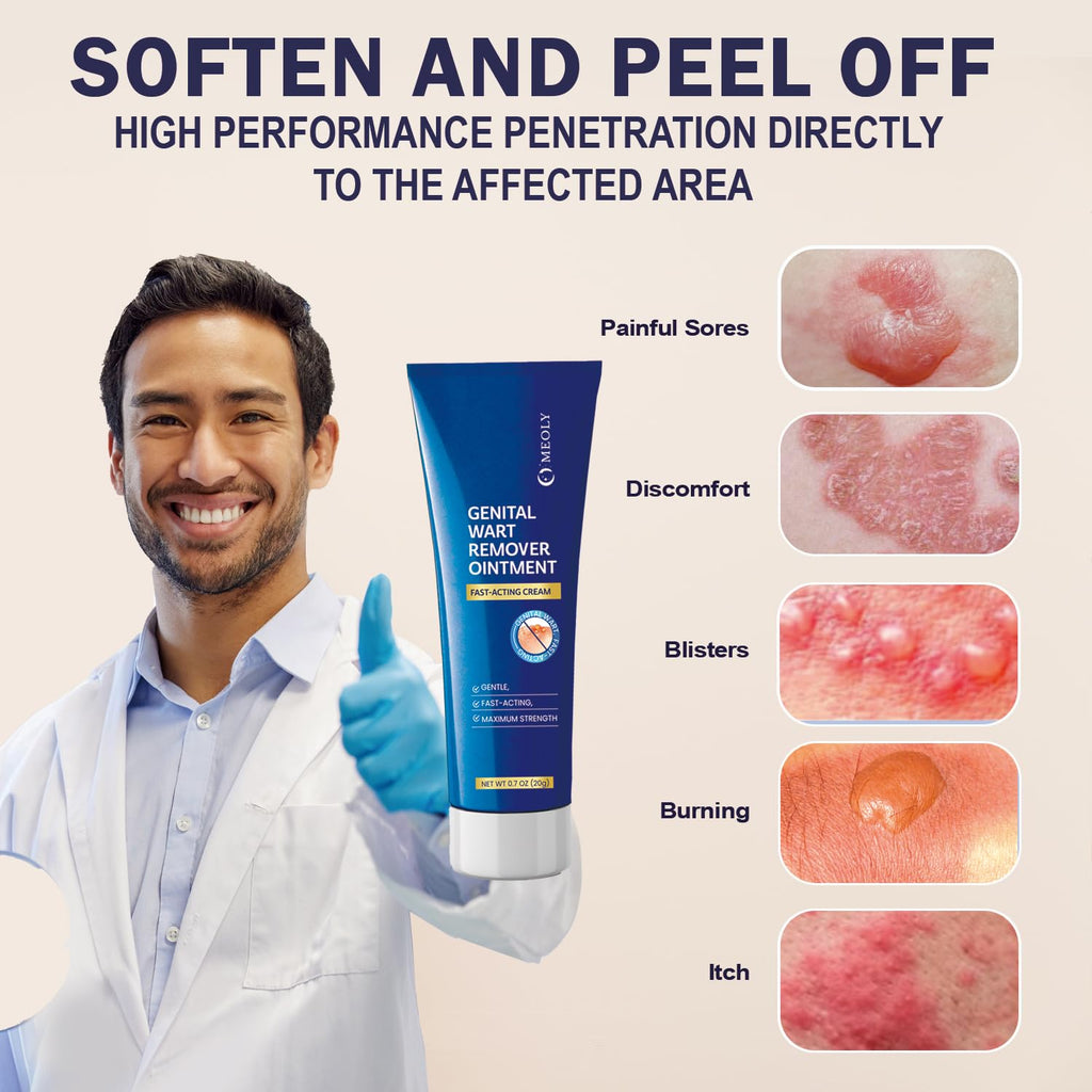 Genital Wart Remover Cream 0.7 oz R842911