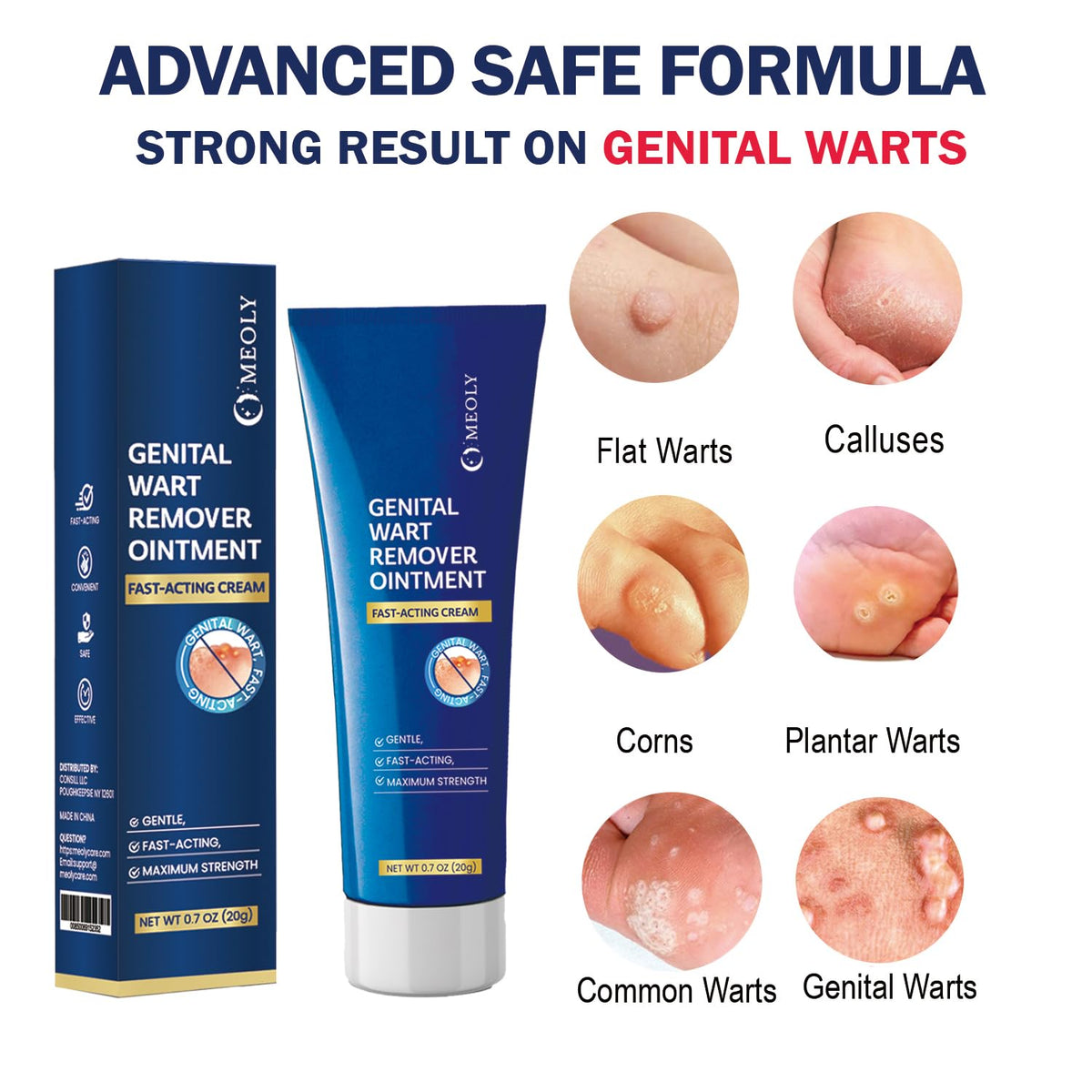 Genital Wart Remover Cream 0.7 oz R842911